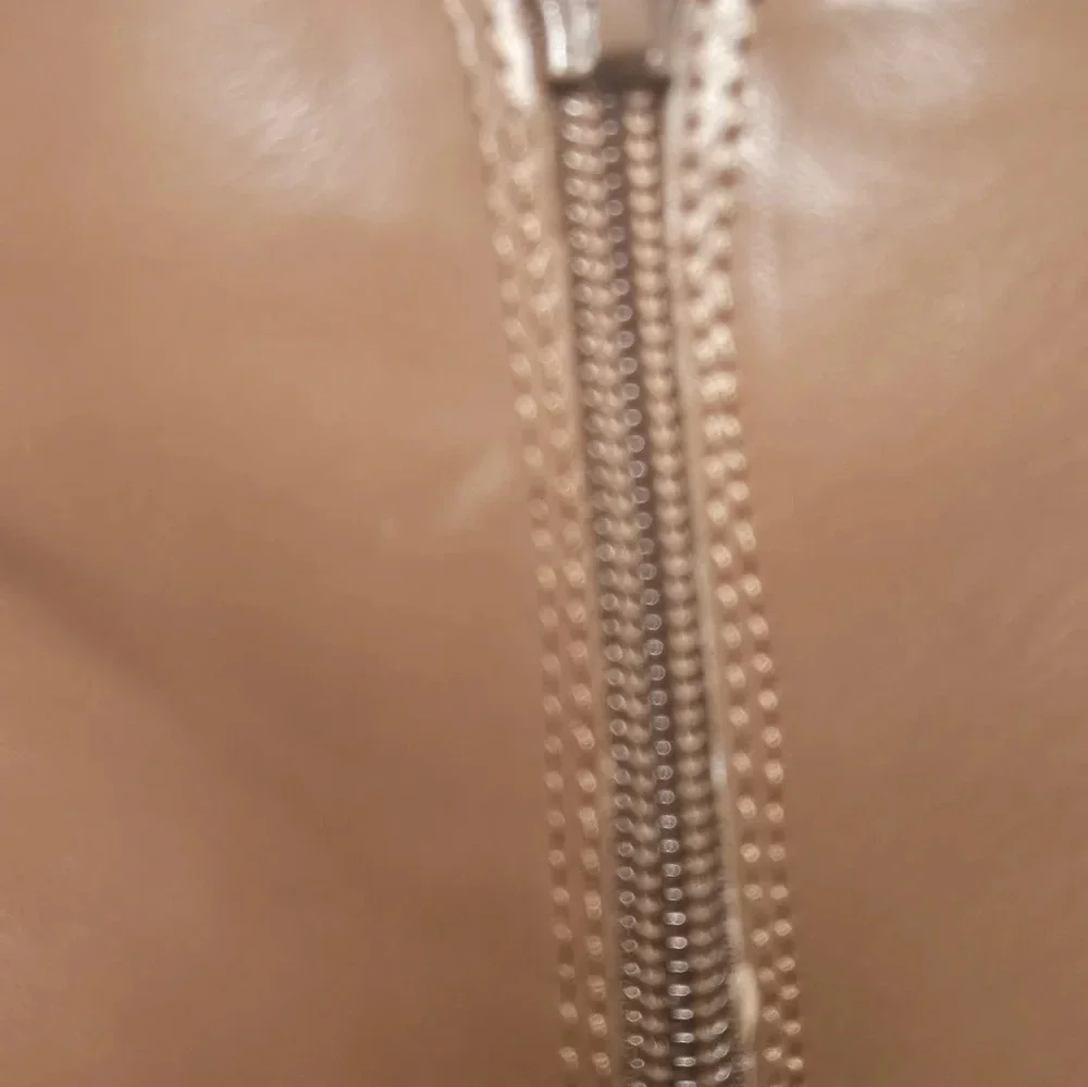 J. Crew minorskin discoloration